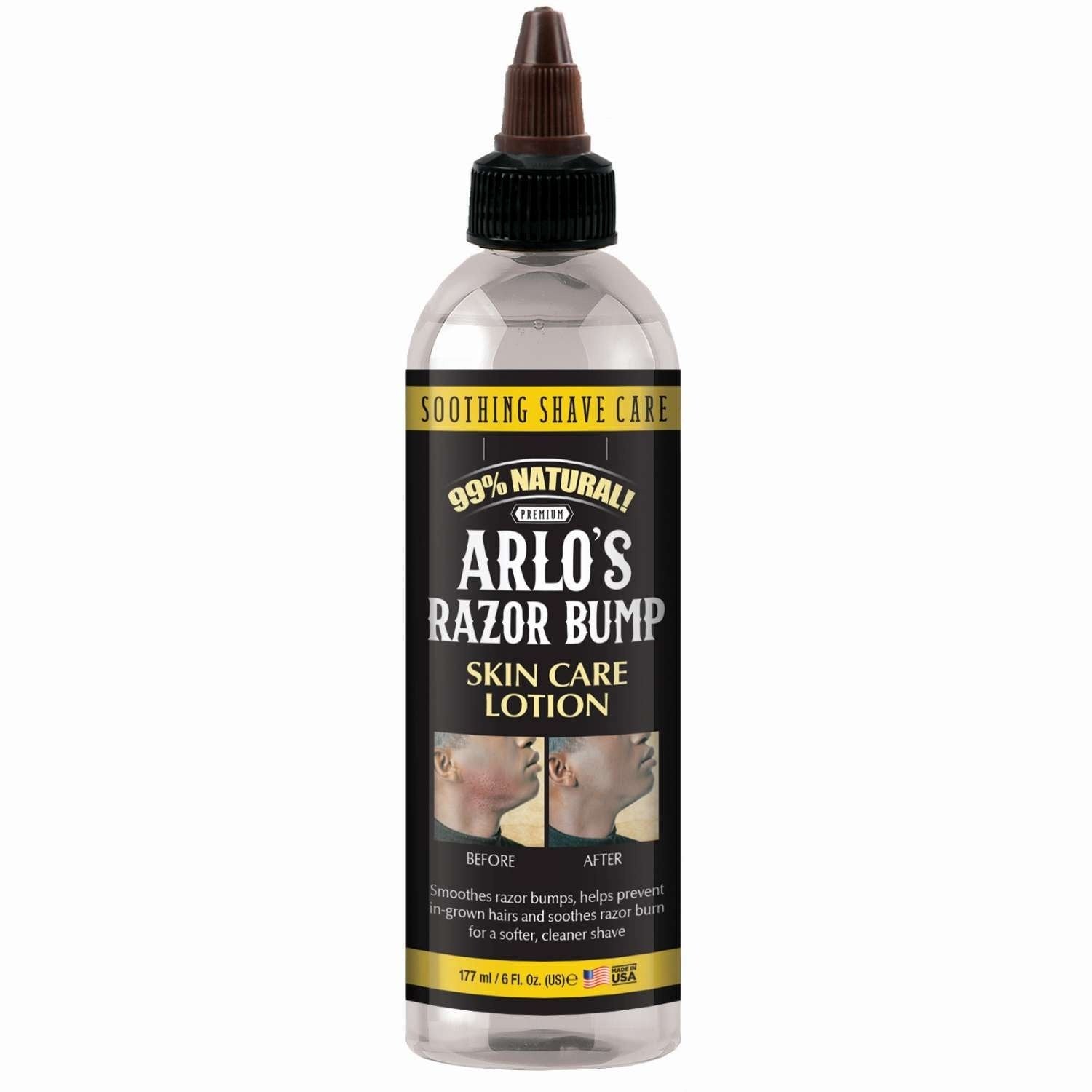 Arlos Razor Bump Skin Care Lotion 6 Oz Arlos Razor Bump Skin Care Lotion 6 Oz